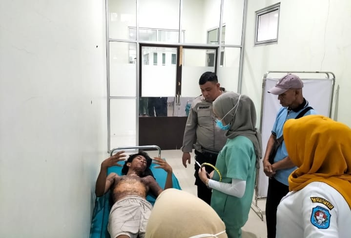 Diduga Disiram Air Panas Gerobak Bakso, Pemuda Kubu Raya Luka Bakar Serius, Pelaku Kabur