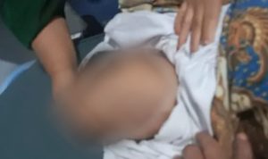 Usai Disuntik Obat Penurun Panas, Balita Kejang Kejang Dan Meninggal Dunia Di Rumah Sakit Tiara, Babelan